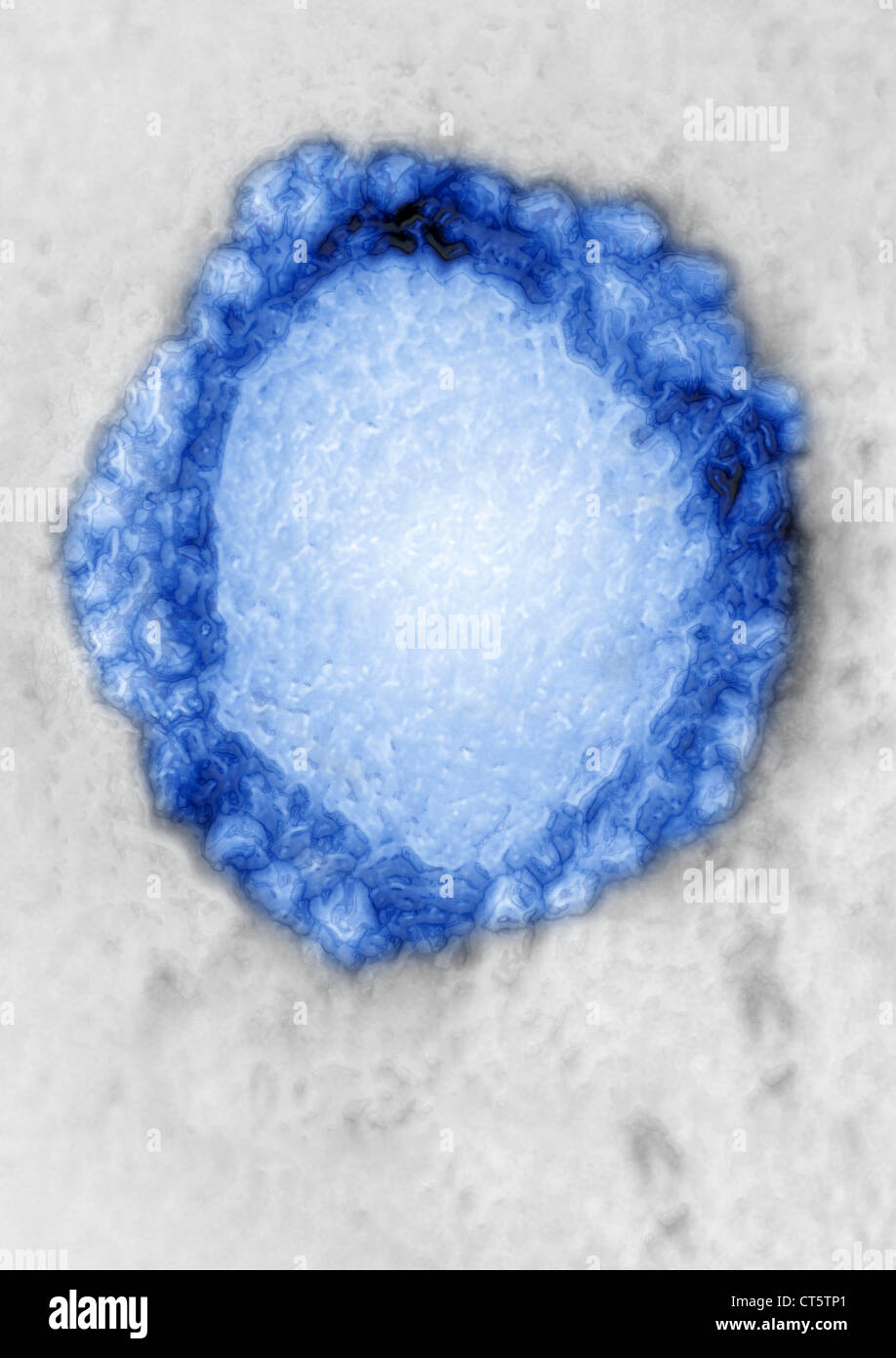 CORONAVIRUS, le TEM Banque D'Images