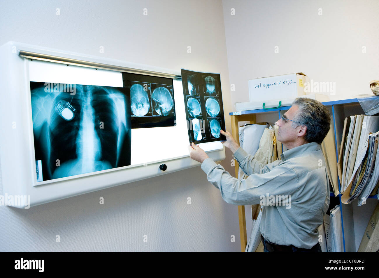 L'électrostimulation DU CERVEAU Banque D'Images