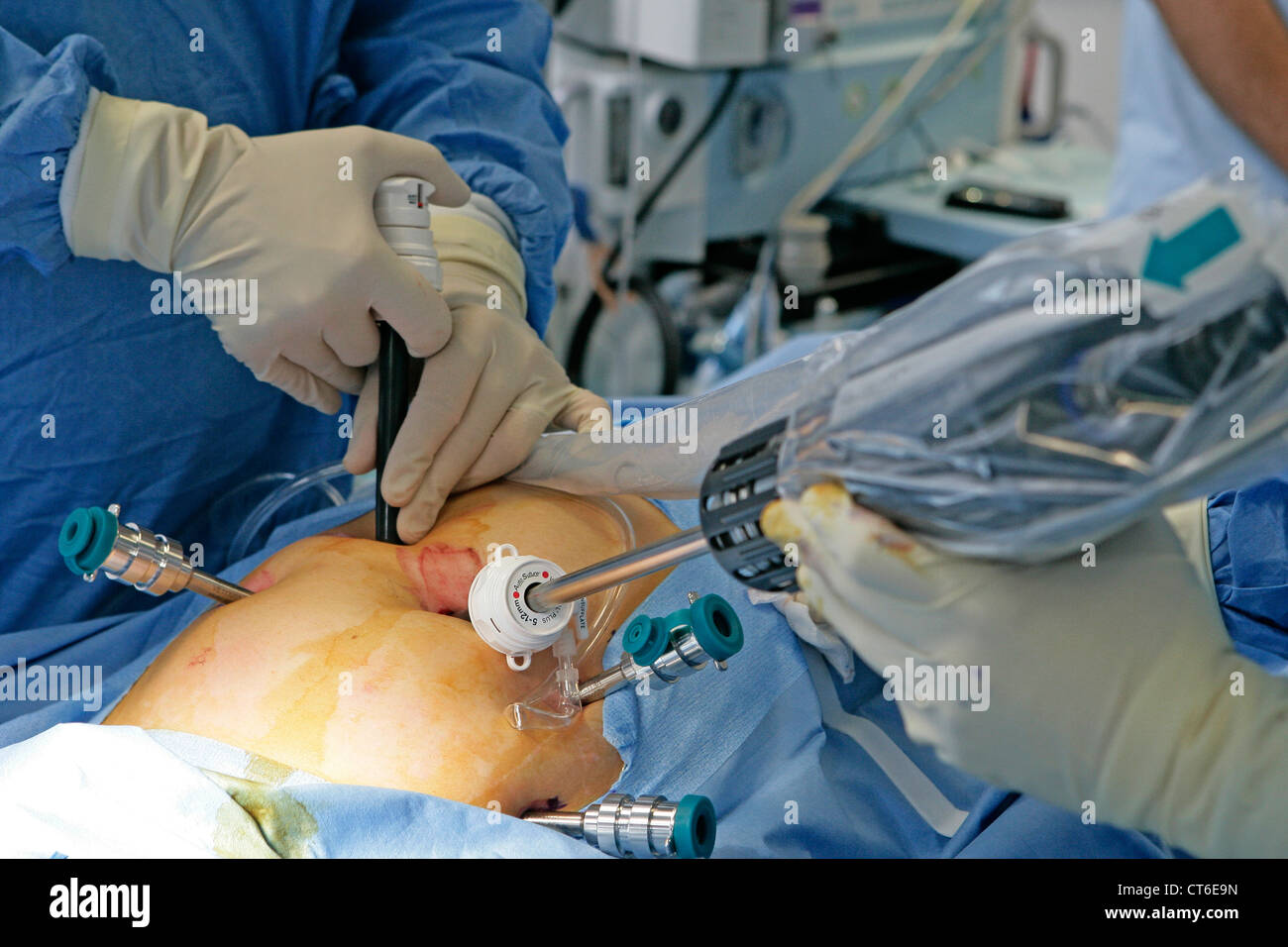 La chirurgie assistée par robot Banque D'Images