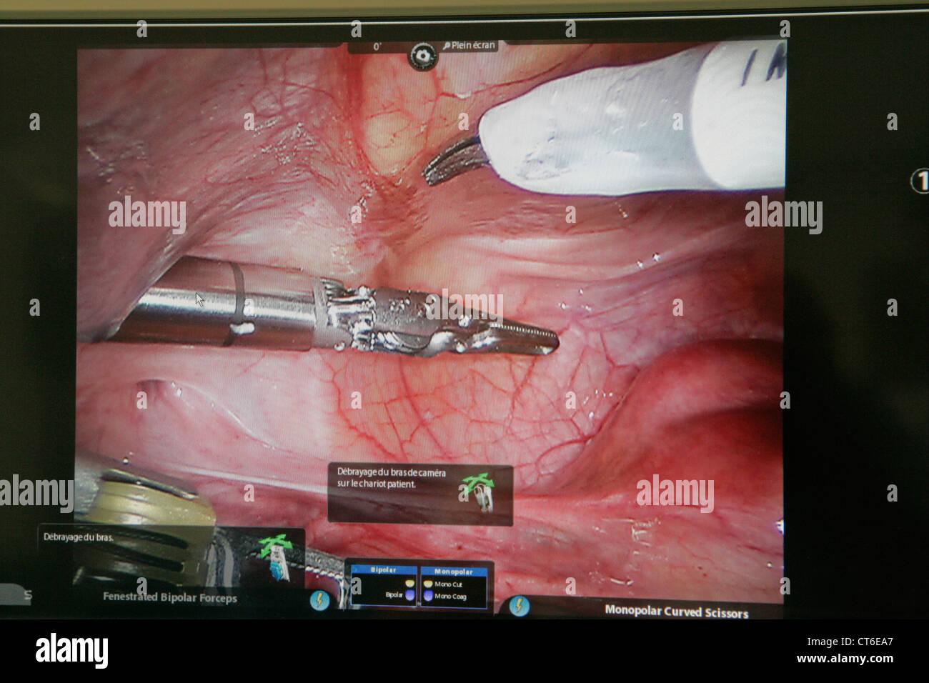 La chirurgie assistée par robot Banque D'Images