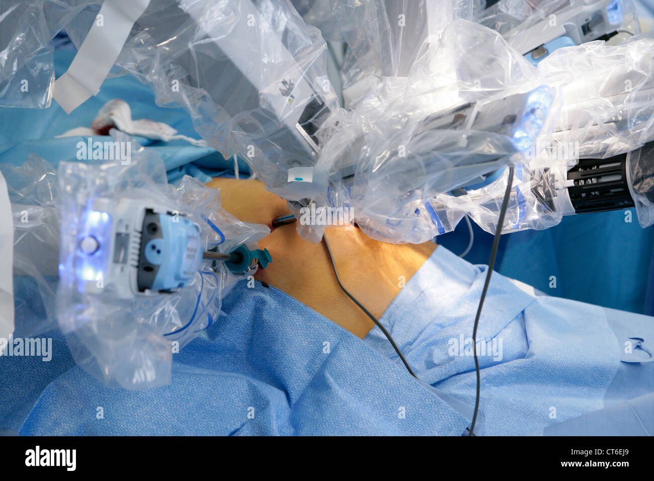 La chirurgie assistée par robot Banque D'Images