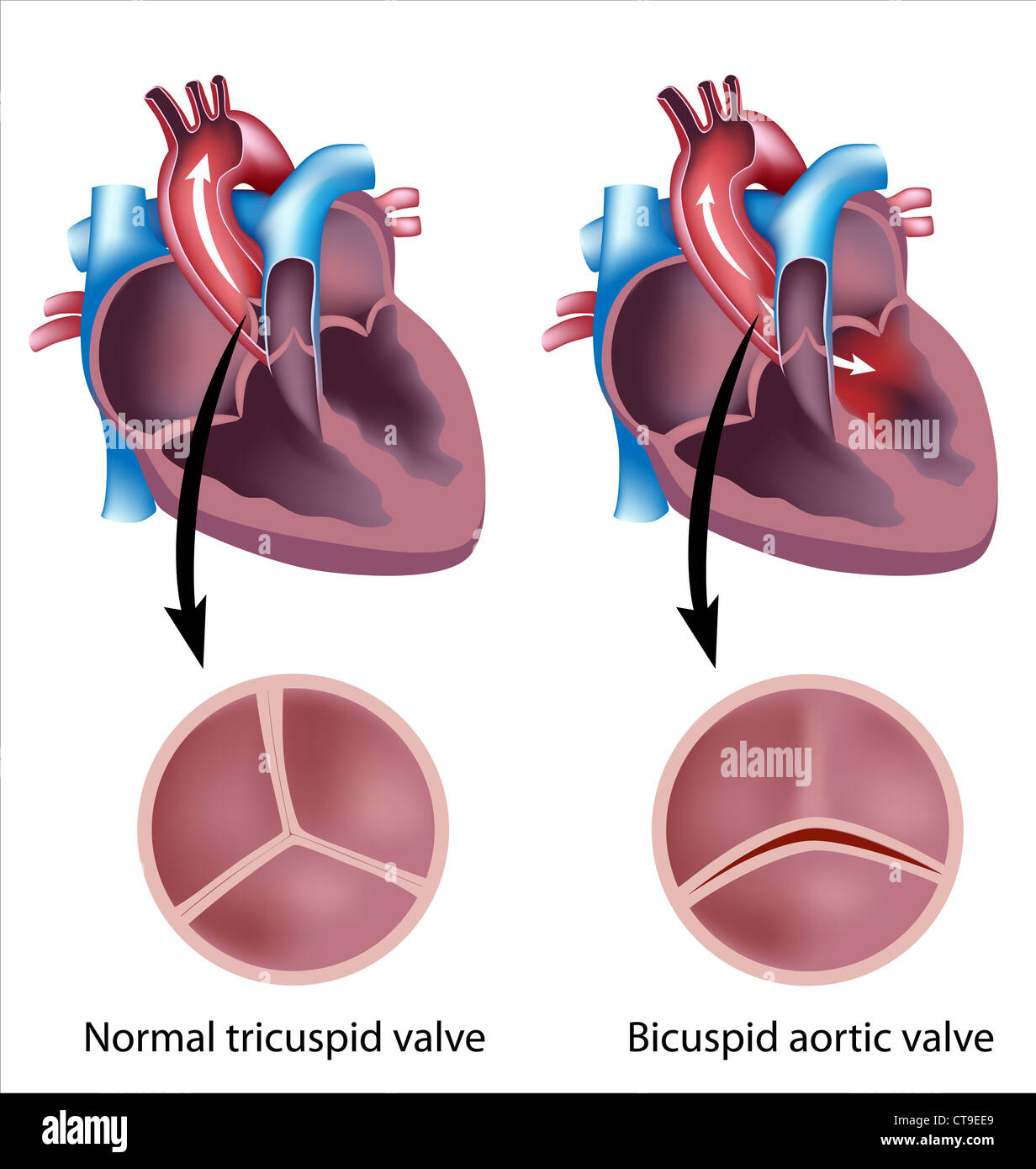 Valve tricuspide de coeur humain Banque de photographies et d'images à  haute résolution - Alamy