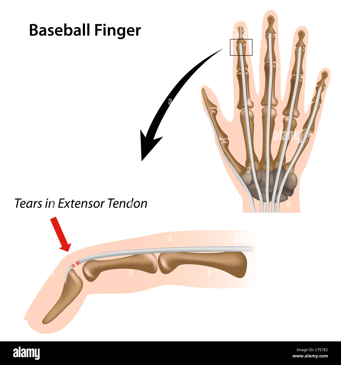 Doigt de baseball Banque D'Images