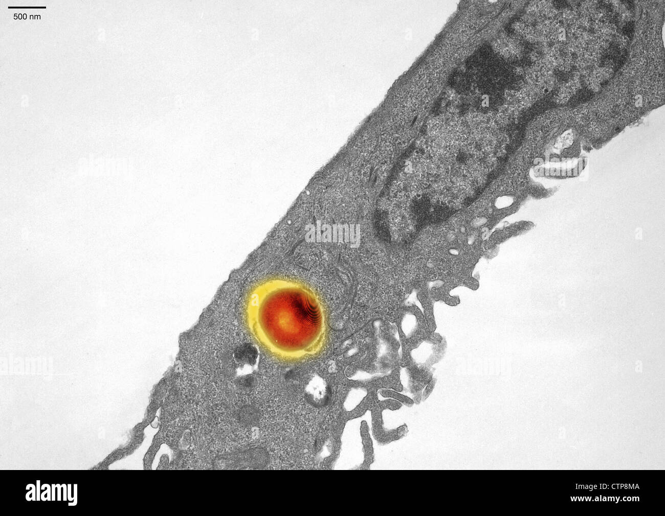 Microscope électronique à transmission (TEM) image d'une 4 heure le Staphylococcus aureus invasion du FT-1 (cellules épithéliales pulmonaires) Banque D'Images