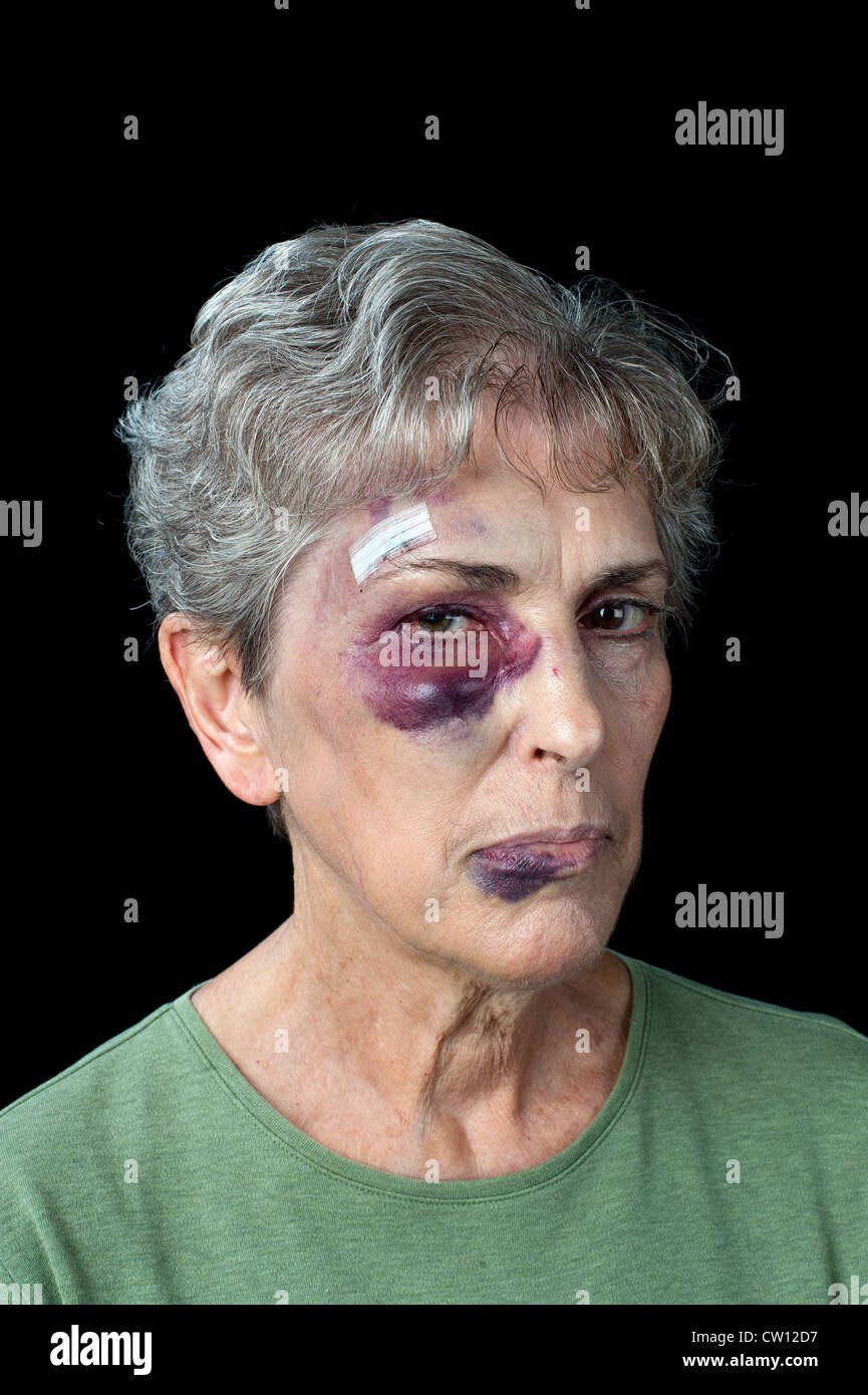 Une femme âgée a battu et meurtri montre les problèmes qui existent avec la violence domestique Banque D'Images