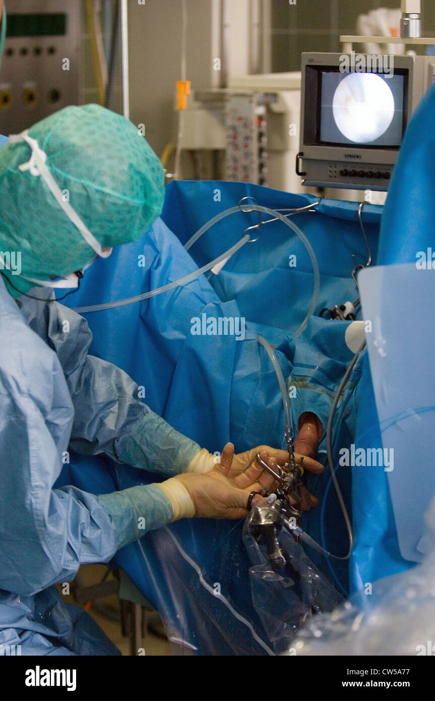 La chirurgie au laser sur la prostate, Berlin Photo Stock - Alamy