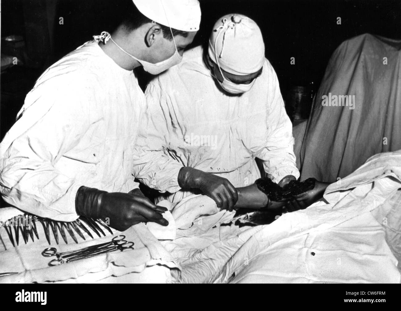 L'équipe chirurgicale américaine inspecte les bras du soldat blessé en France (1945) Banque D'Images