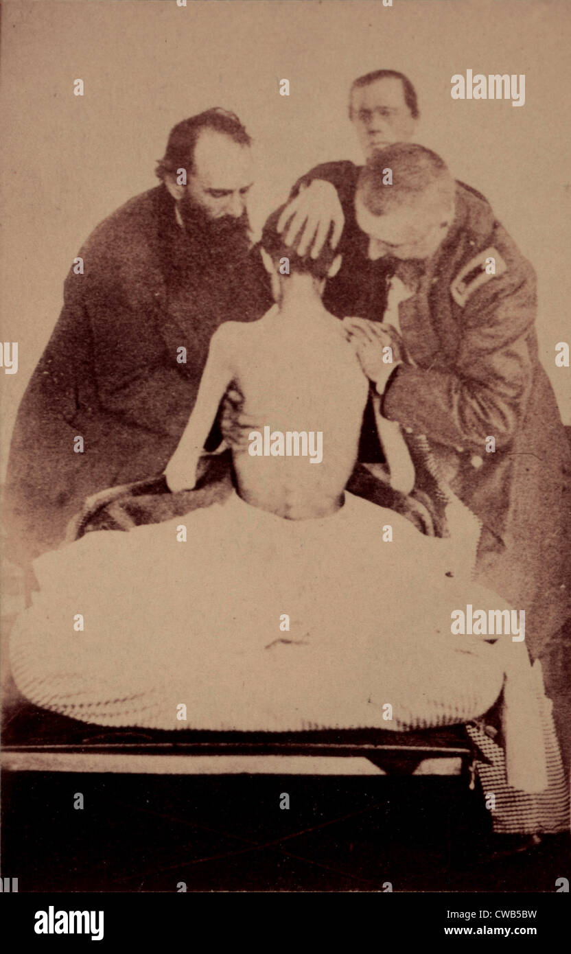 La guerre civile, les médecins de l'examen d'un prisonnier fédéral est revenu de prison, photographie circa 1861-1865. Banque D'Images
