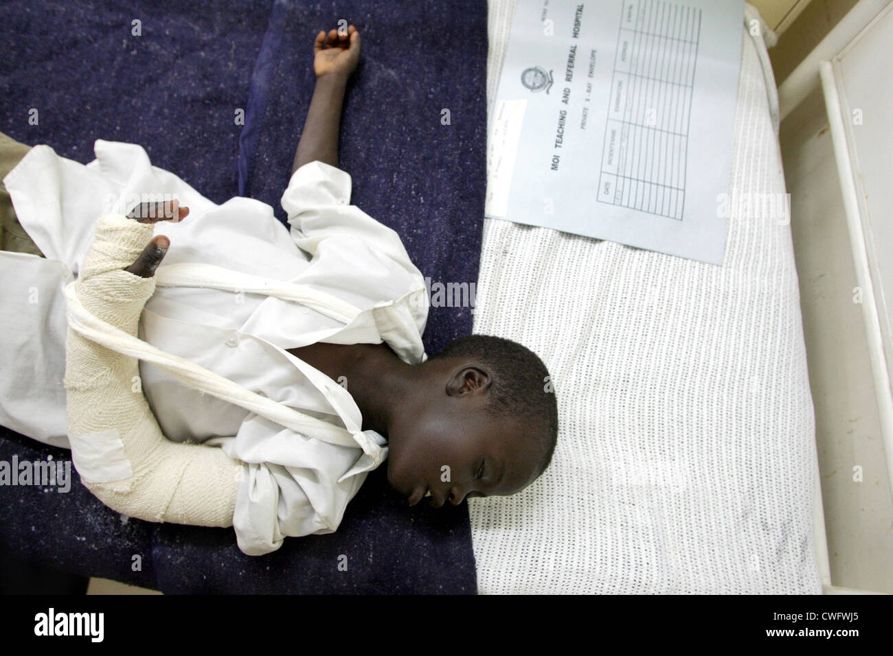 Au Kenya, un jeune patient avec un bras cassé en sommeil Moi University Hospital Banque D'Images