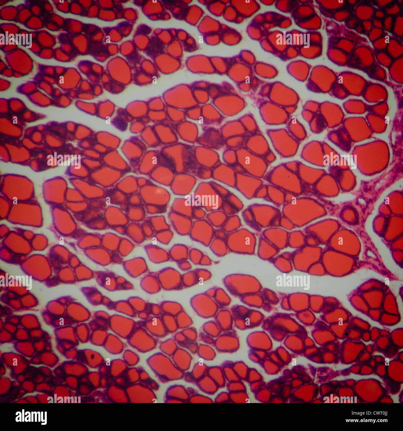Medical science anthropotomy article microscopique physiologie de la glande thyroïde background Banque D'Images
