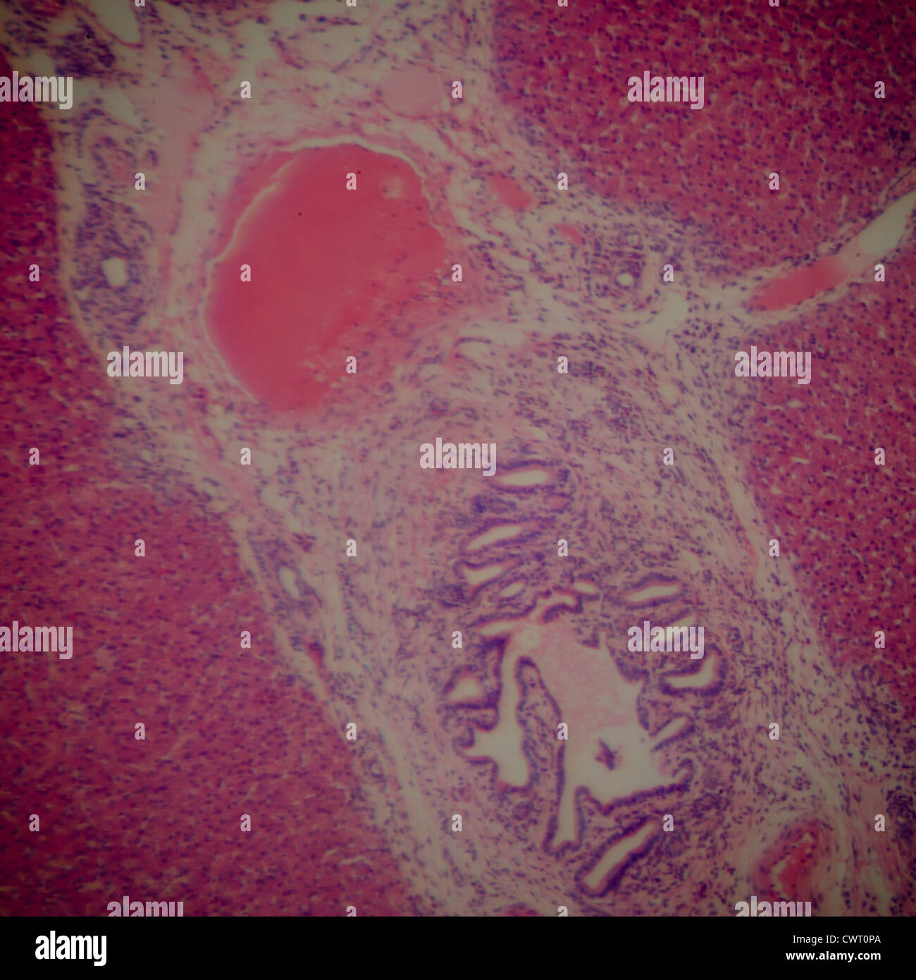 Medical science anthropotomy article microscopique physiologie du tissu hépatique Banque D'Images
