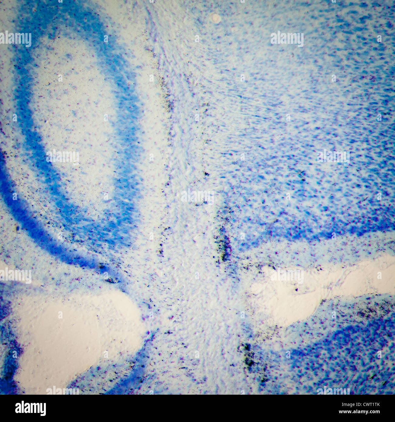 Microscopie médicale la science du cerveau de rat micrograph, les neurones de l'Hippocampe Banque D'Images