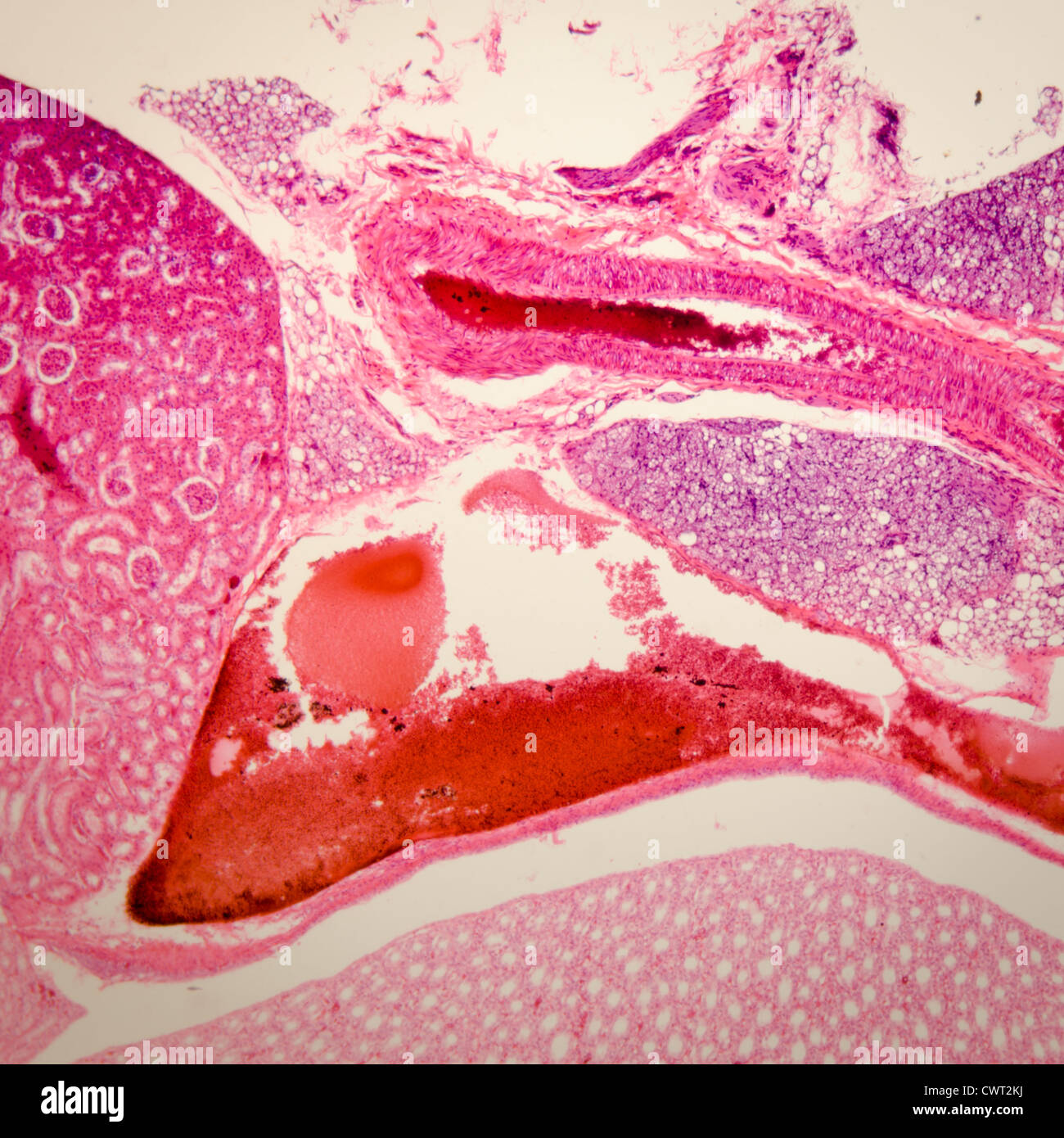 Medical science anthropotomy article microscopique physiologie du tissu rénal background Banque D'Images