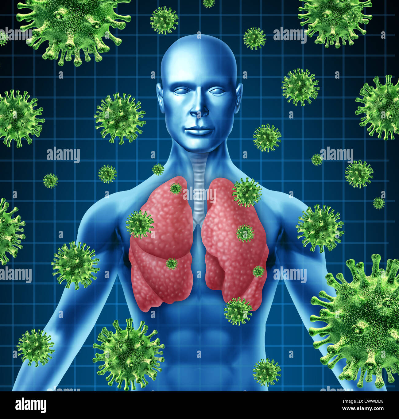 Infection pulmonaire, représenté par un humain avec x-ray image des poumons et du corps avec des cellules virus attaquant le patient d'un état Banque D'Images