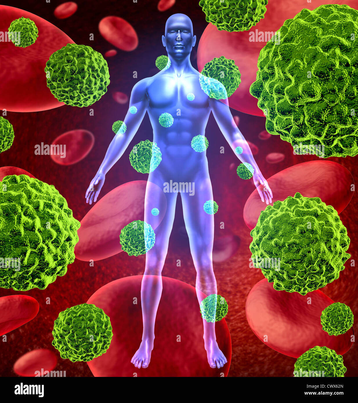 Corps humain avec les cellules cancéreuses et de plus en plus répandre à travers le corps via le sang rouge comme les cellules malignes en raison de carcinogènes environnementaux et génétiques des tumeurs et des lésions cellulaires. Banque D'Images