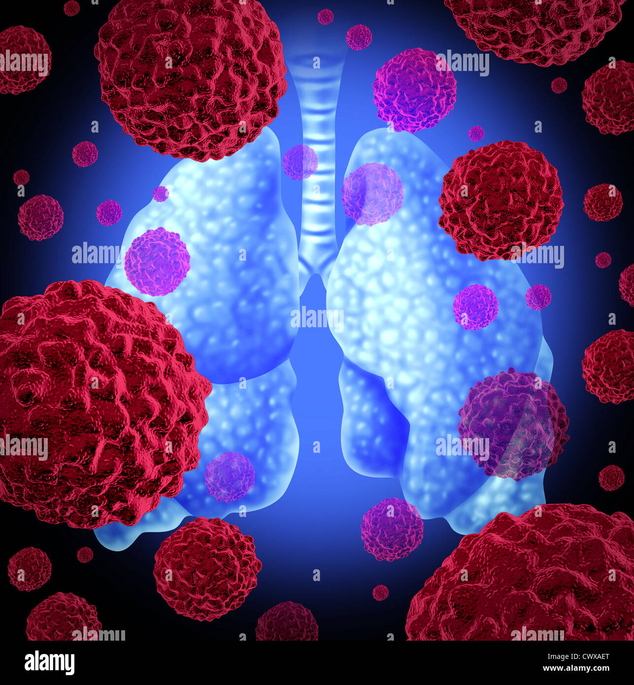 Le cancer du poumon l'organe comme un symbole médical d'une tumeur maligne à cellules de cancer rouge comme une croissance cancéreuse se propage dans le système respiratoire causée par le tabagisme et d'autres toxiques environnementaux raisons. Banque D'Images