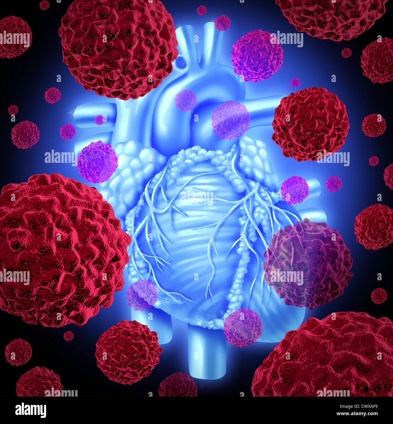 Coeur de l'homme soins de santé cancer medicine concept avec l'organe humain intérieur rouge et des cellules de cancer dans la propagation des tumeurs formant Banque D'Images