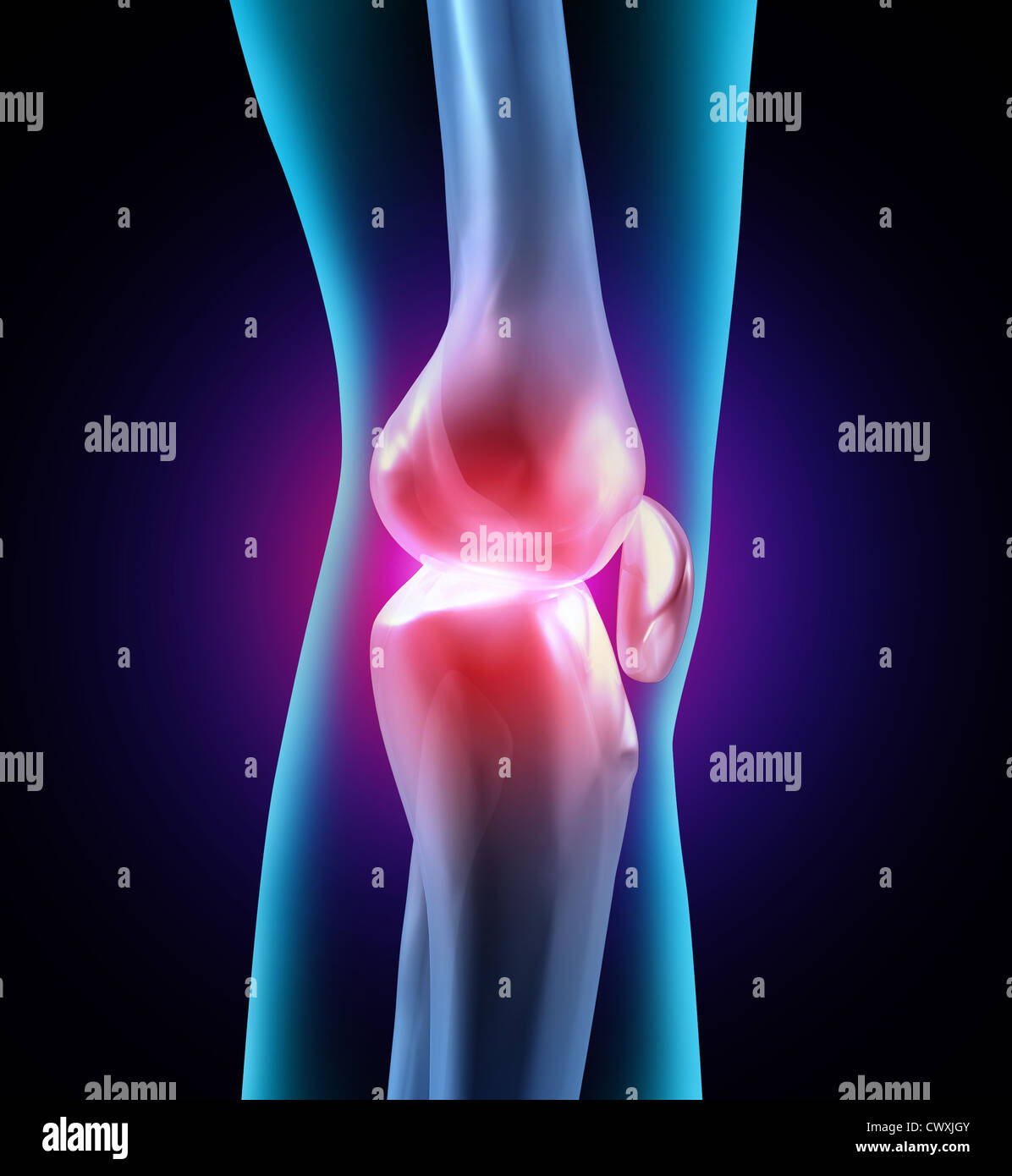 L'inconfort et des articulations humaines douloureuses comme une illustration médicale avec de l'os l'anatomie et de voir à travers la partie du corps montrant les problèmes de soins de santé avec la flexibilité et l'arthrite ayant besoin d'orthopédie connexes thérapie assistée par un médecin. Banque D'Images