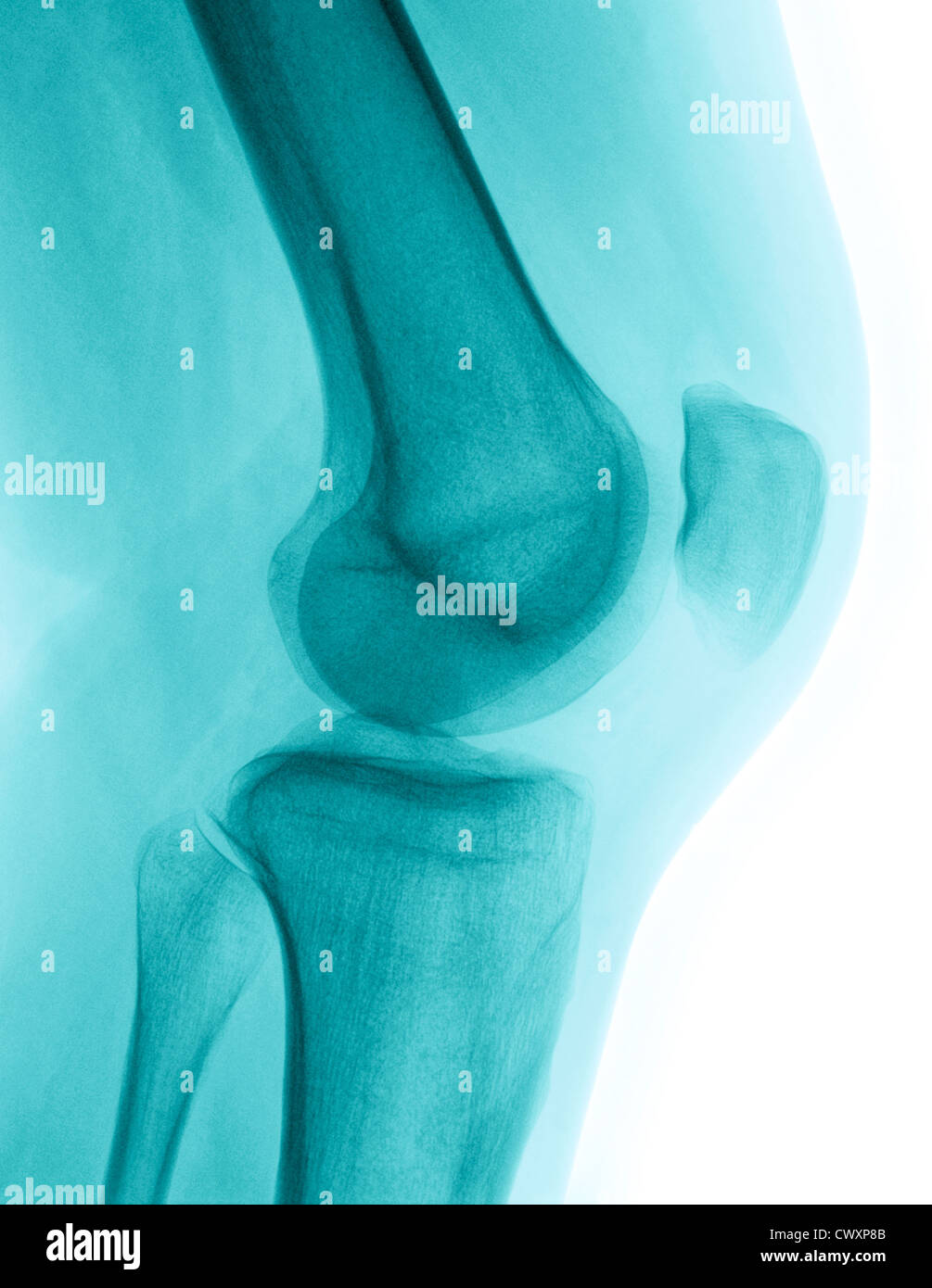 X-ray détaillée d'un environnement humain le genou droit. Image créée à l'aide de la radiographie numérique moderne Banque D'Images