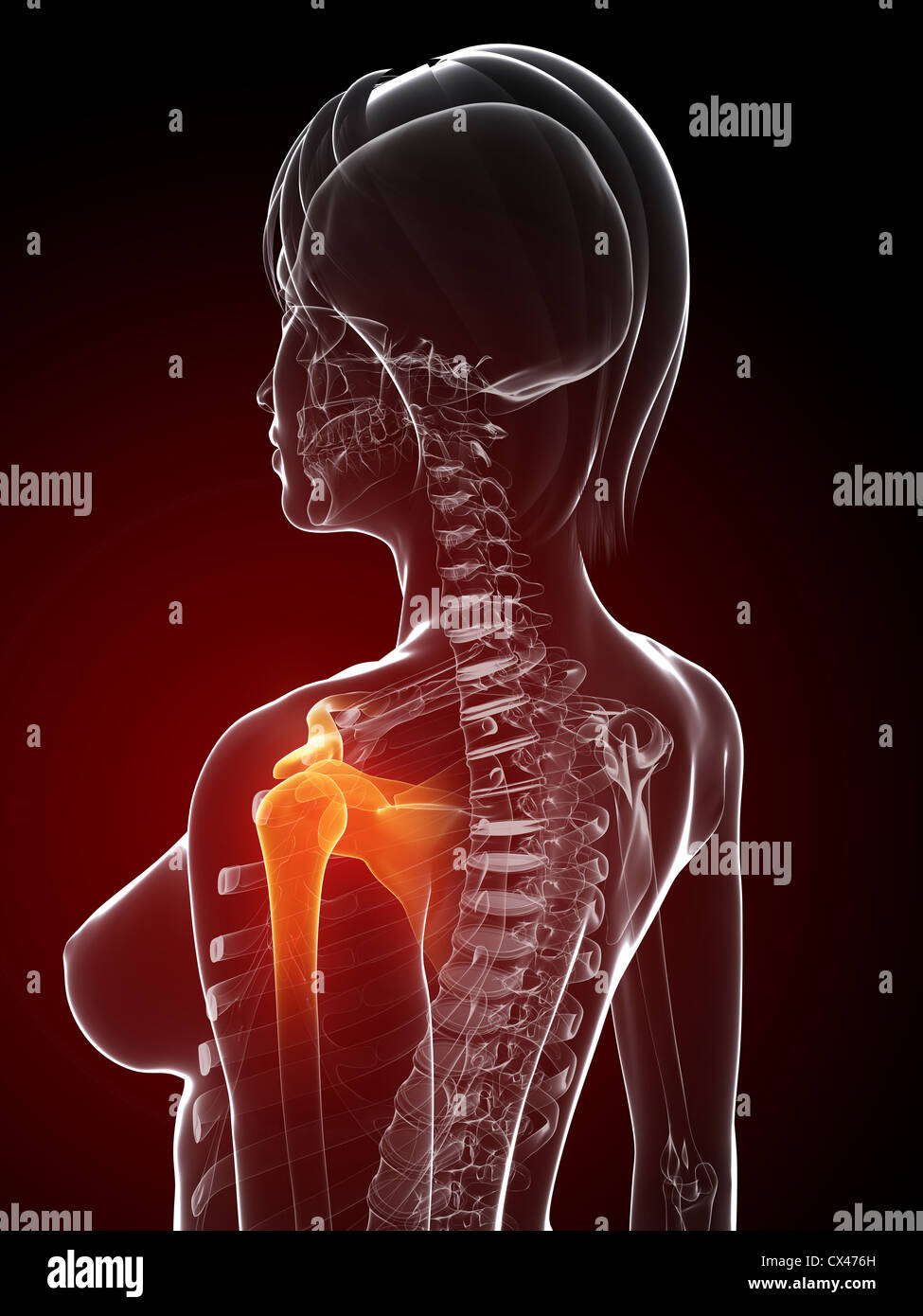 Anatomie en rendu 3d illustration - l'épaule douloureuse Banque D'Images