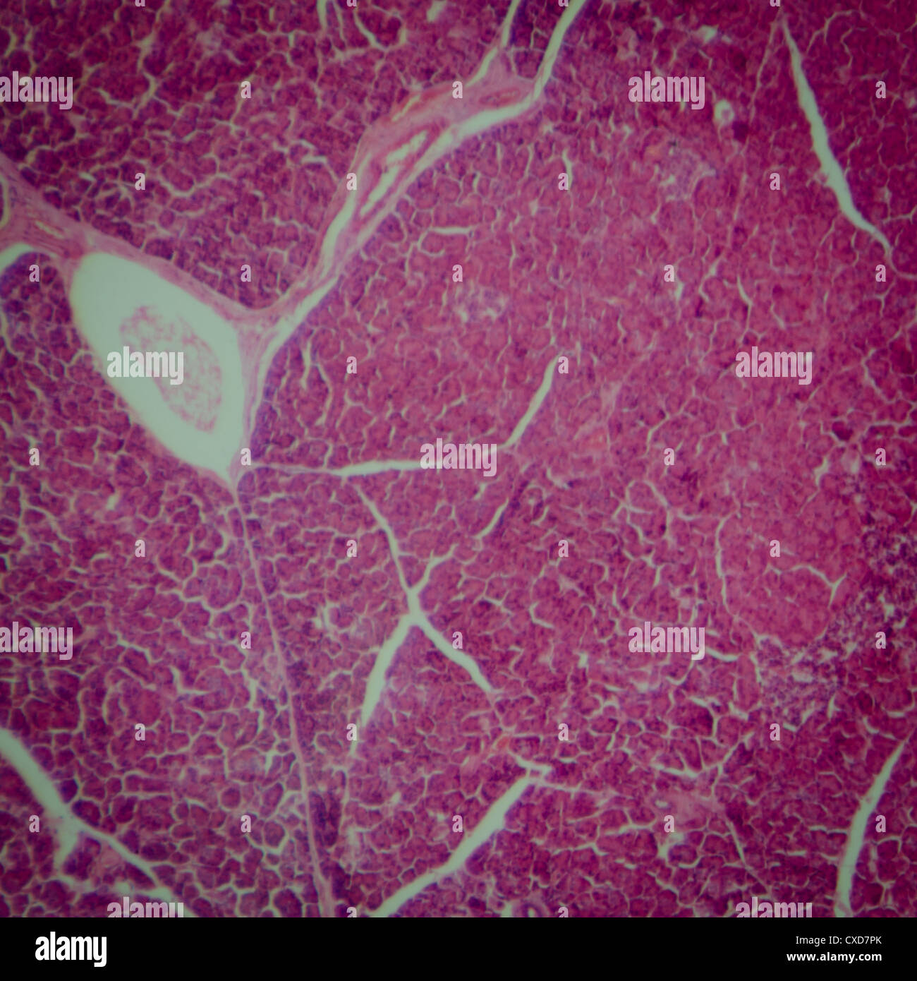 La section des droits de l'pancréas microscopique Banque D'Images