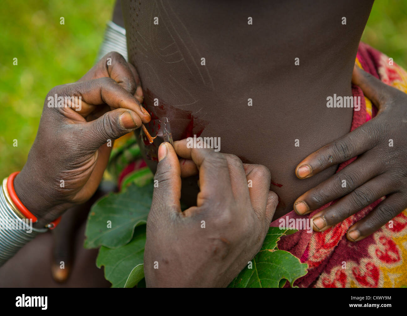 Détail de la ventre d'une femme lors d'une tribu Suri Cérémonie scarification, Tulgit, vallée de l'Omo, Ethiopie Banque D'Images