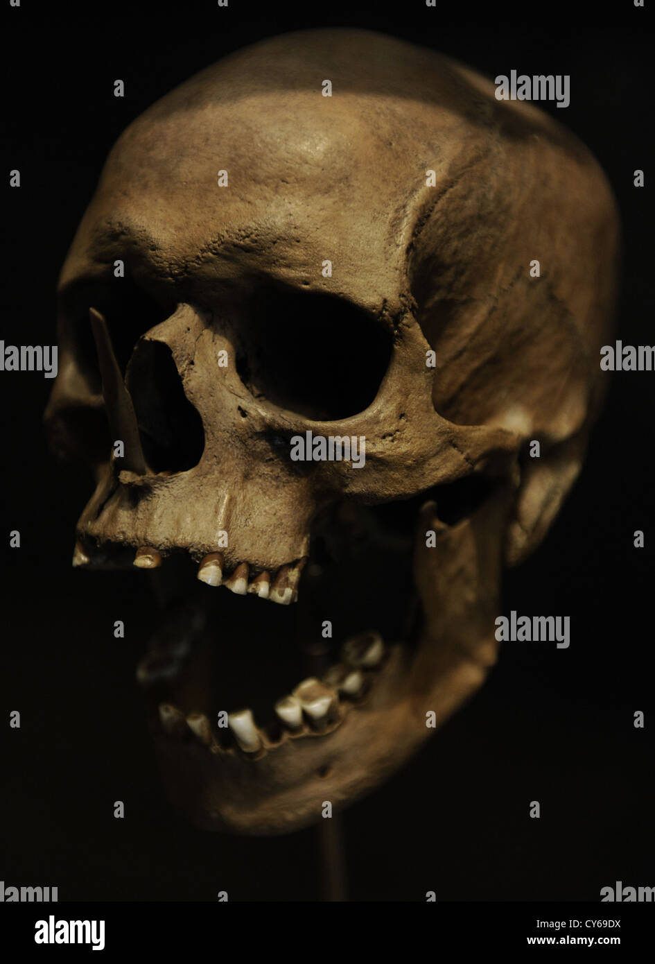 Crâne d'un homme 35-40 ans tués par des flèches. 3500 BC. Porsmose, le sud de la Nouvelle-Zélande. Musée national du Danemark. Banque D'Images