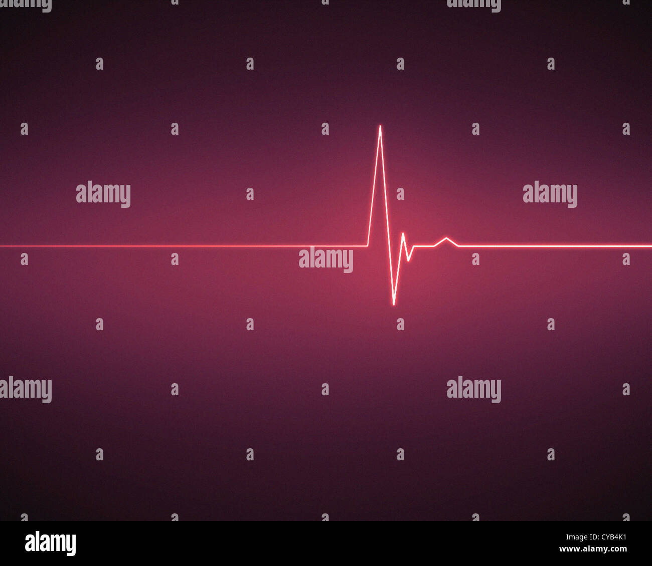 Signal ECG rose Banque D'Images