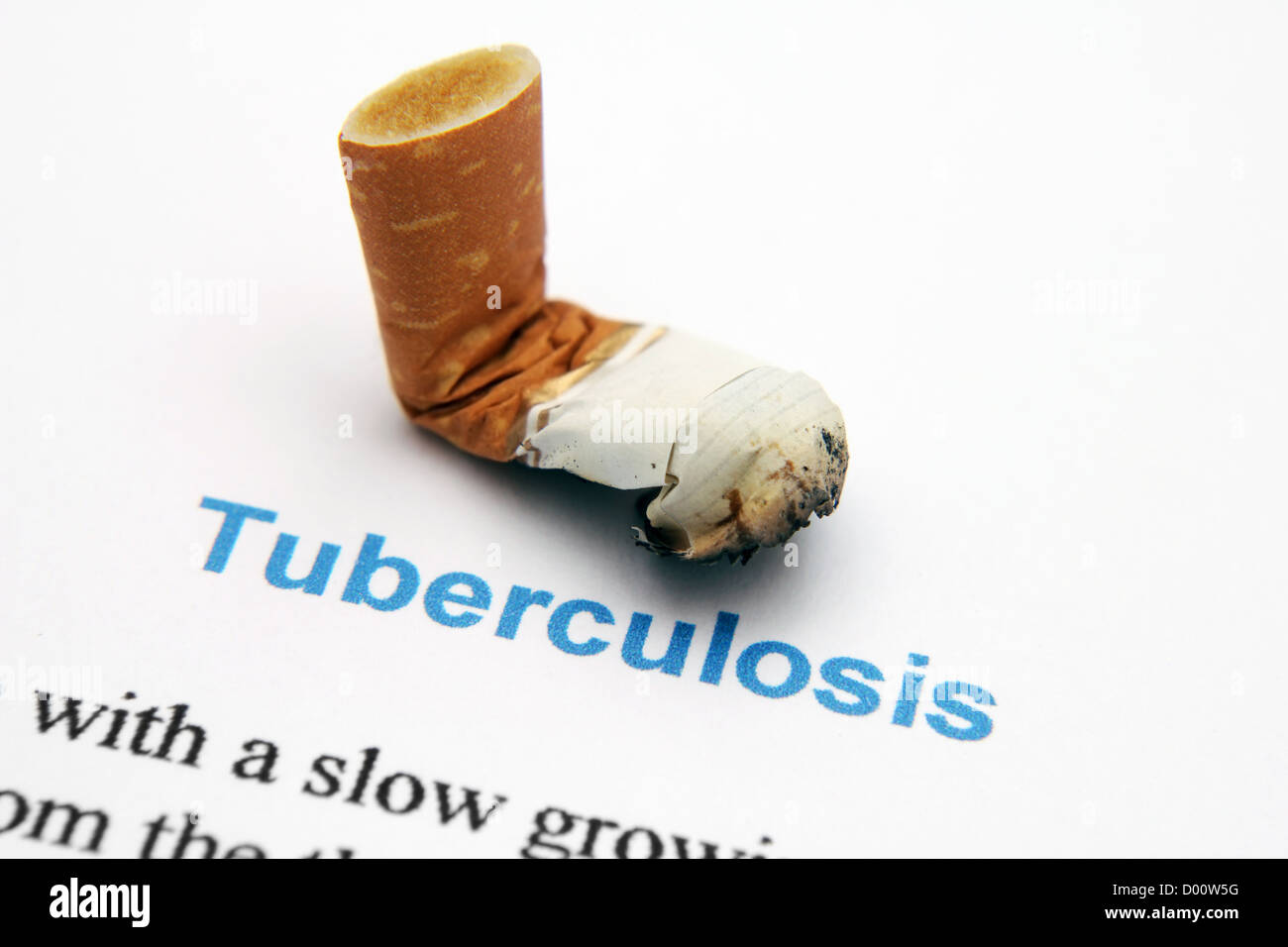 Tuberculose Banque D'Images