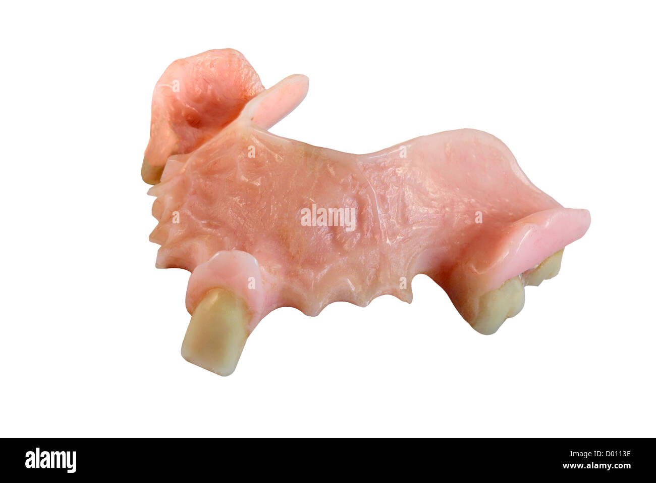 Une prothèse partielle isolé sur fond blanc Banque D'Images