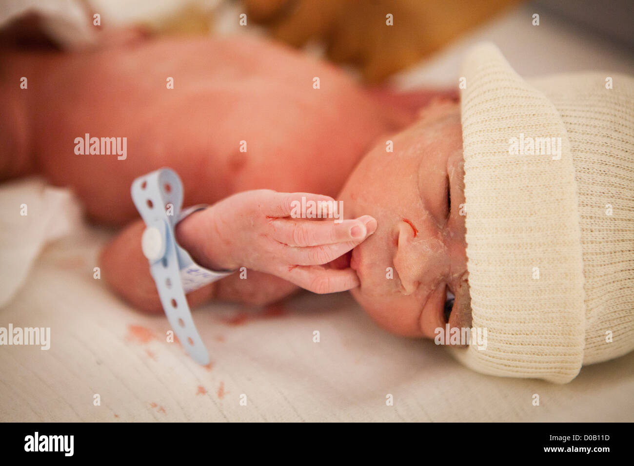 BÉBÉ PRÉMATURÉ Banque D'Images