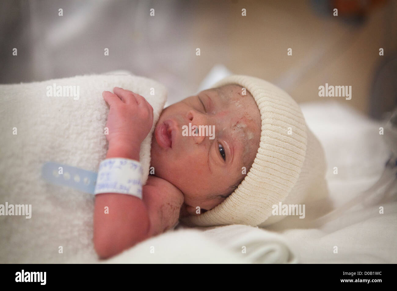 BÉBÉ PRÉMATURÉ Banque D'Images