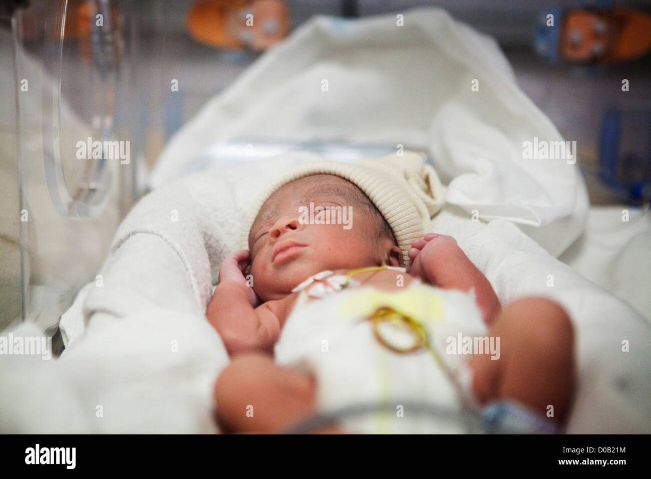 BÉBÉ PRÉMATURÉ Banque D'Images