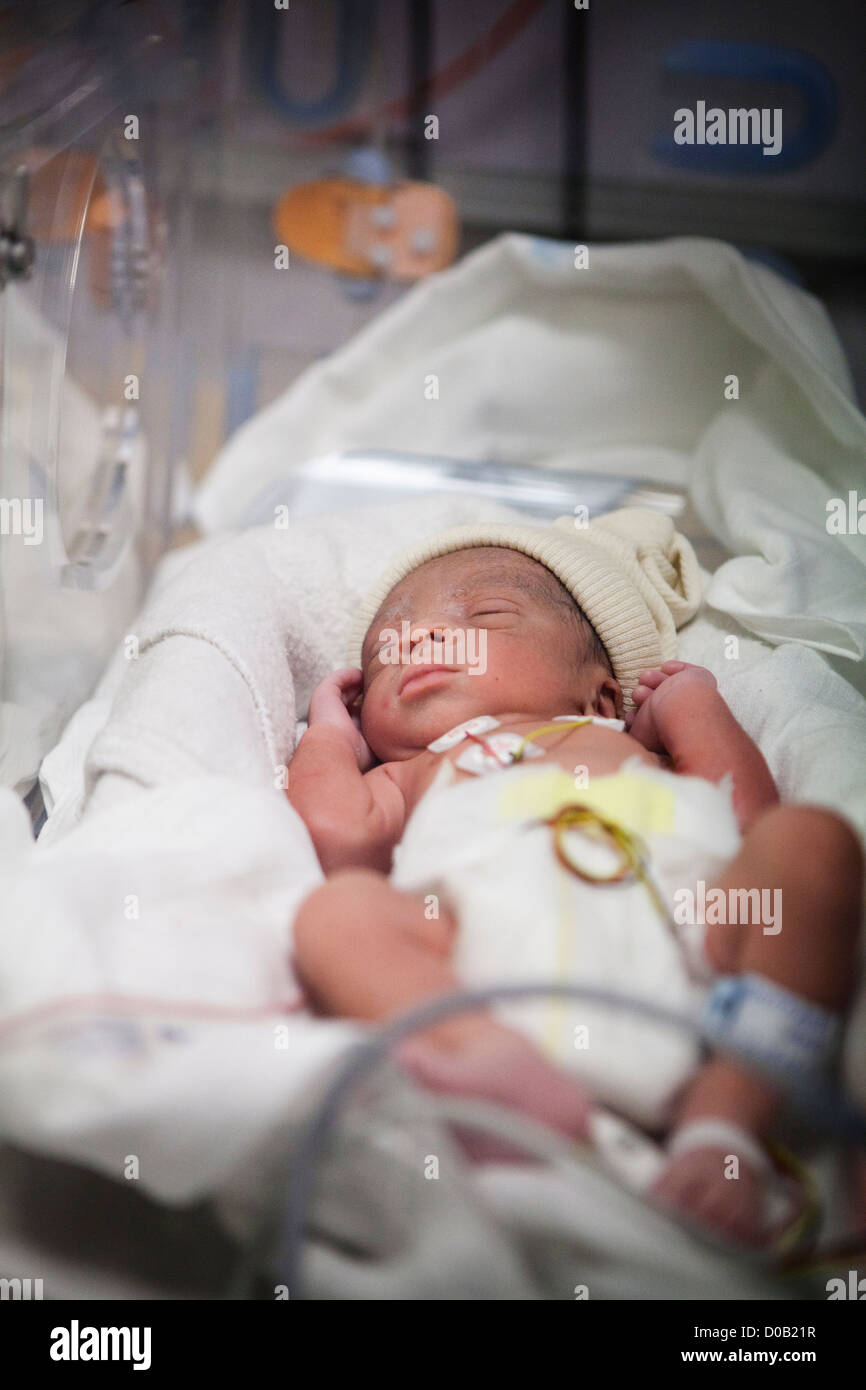 BÉBÉ PRÉMATURÉ Banque D'Images