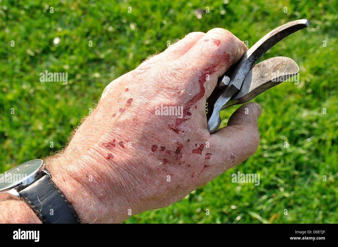 Endommagé après avoir coupé la main de ronces avec un sécateur. Banque D'Images