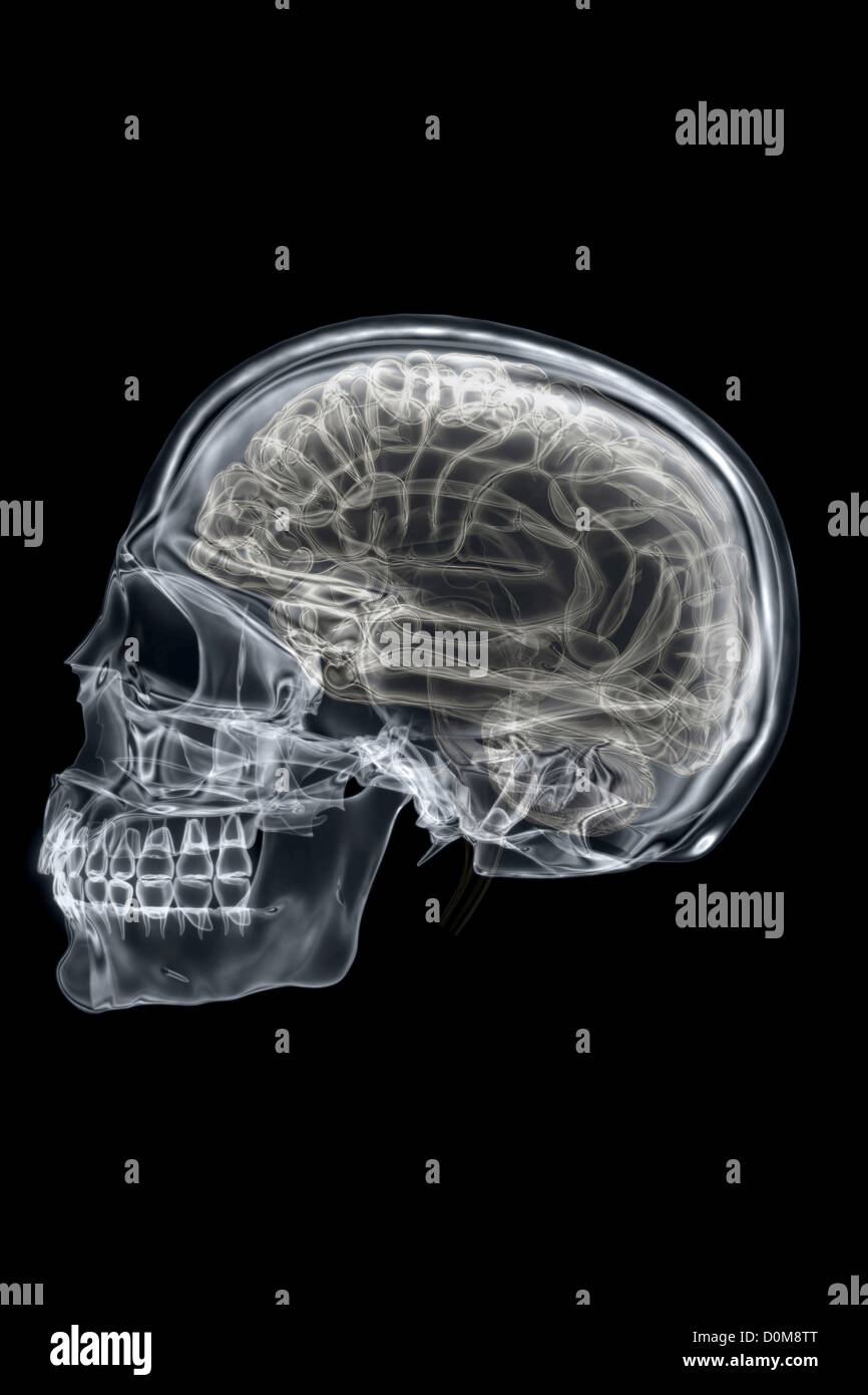 X-ray styled vue latérale du crâne et du cerveau. Banque D'Images