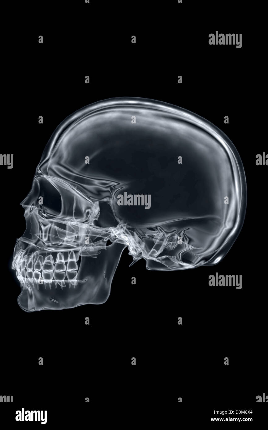 X-ray styled vue latérale du crâne. Banque D'Images