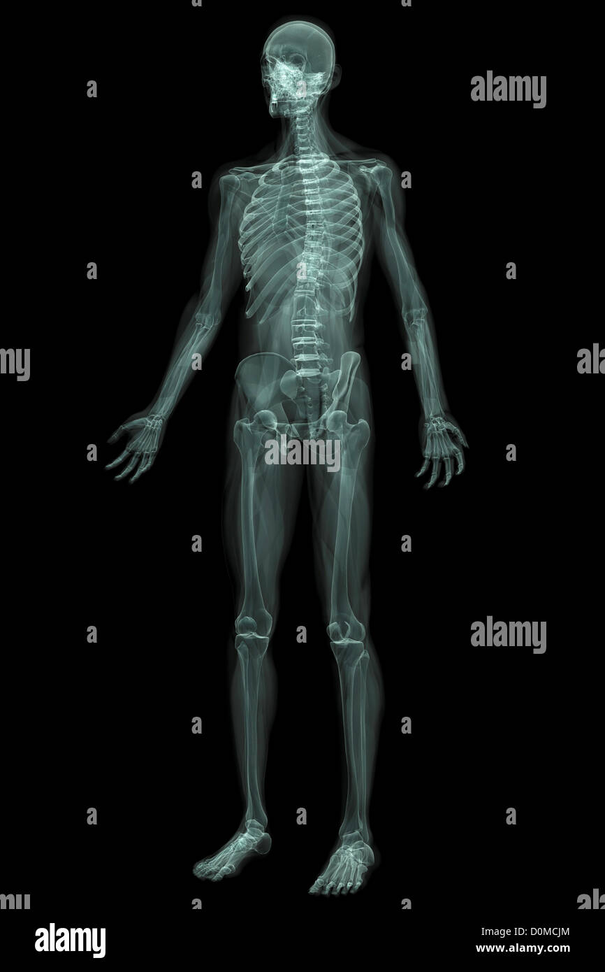 X-ray image montrant l'ensemble du corps humain. Banque D'Images