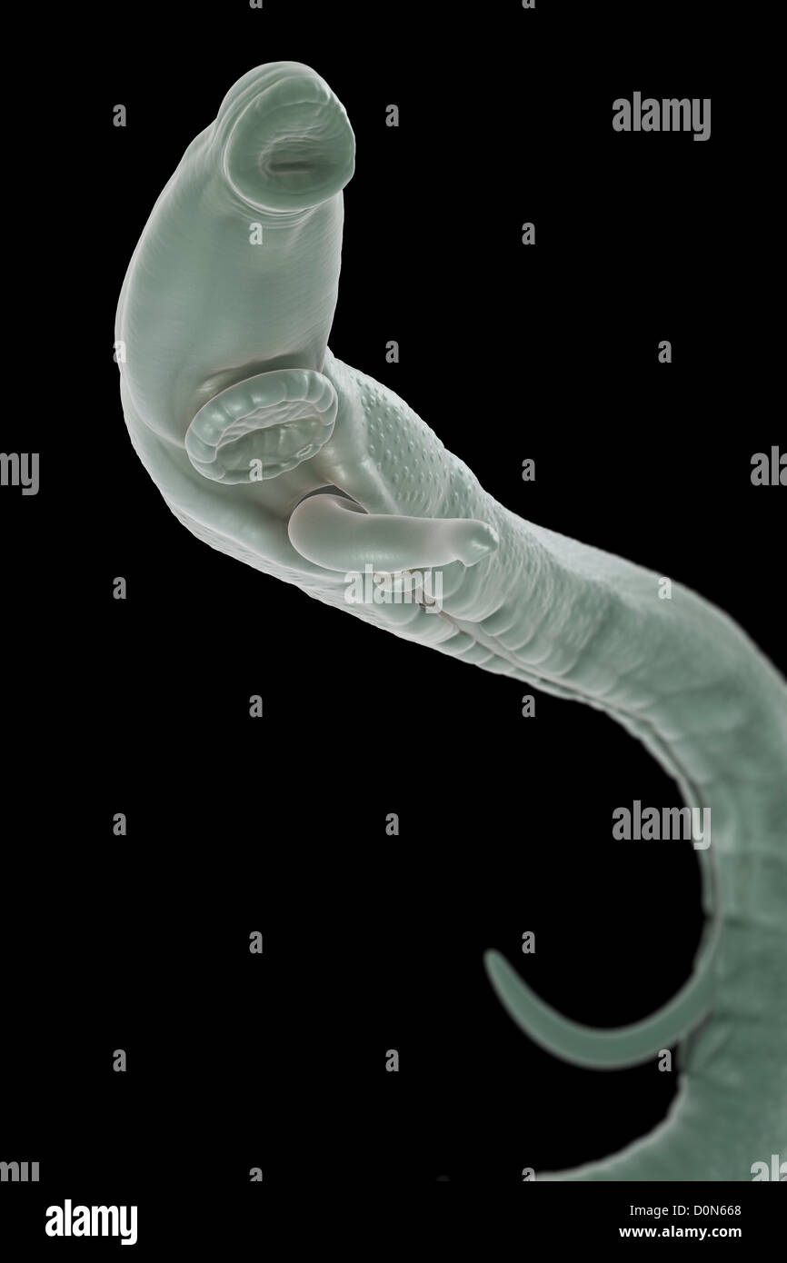 La schistosomiase également connu sous le nom de fièvre de l'escargot est maladie parasitaire causée vers parasite genre Schistosoma. hommes femmes adultes sont Banque D'Images