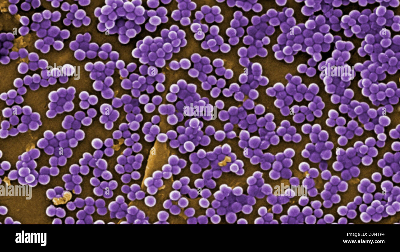 Cette 2005 colorized l'analyse des électrons Microphotographie (SEM) représenté de nombreuses touffes au Staphylococcus aureus Banque D'Images