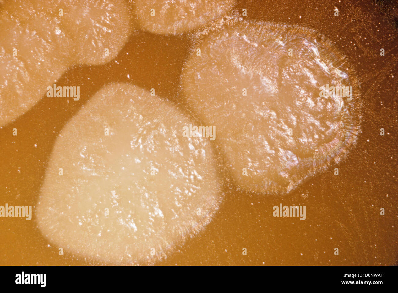 Clostridium botulinum de type E zone opaque en vertu de colonies sur 48 heures d'œuf (gélose de 1,9X). Clostridium botulinum de type E est Banque D'Images