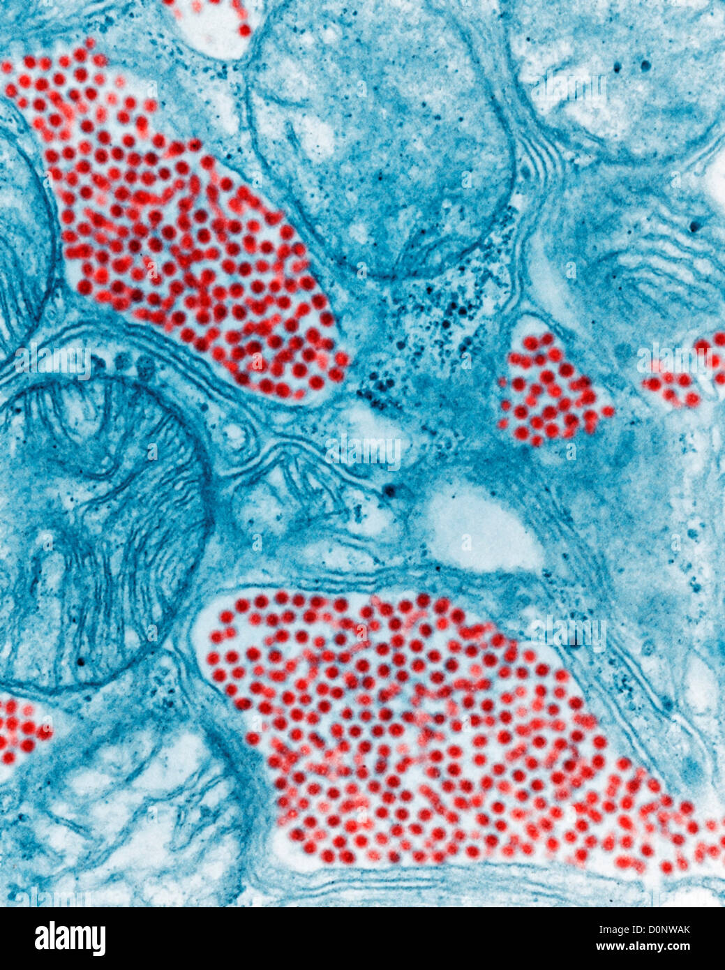 transmission-electron-microscopy-banque-de-photographies-et-d-images