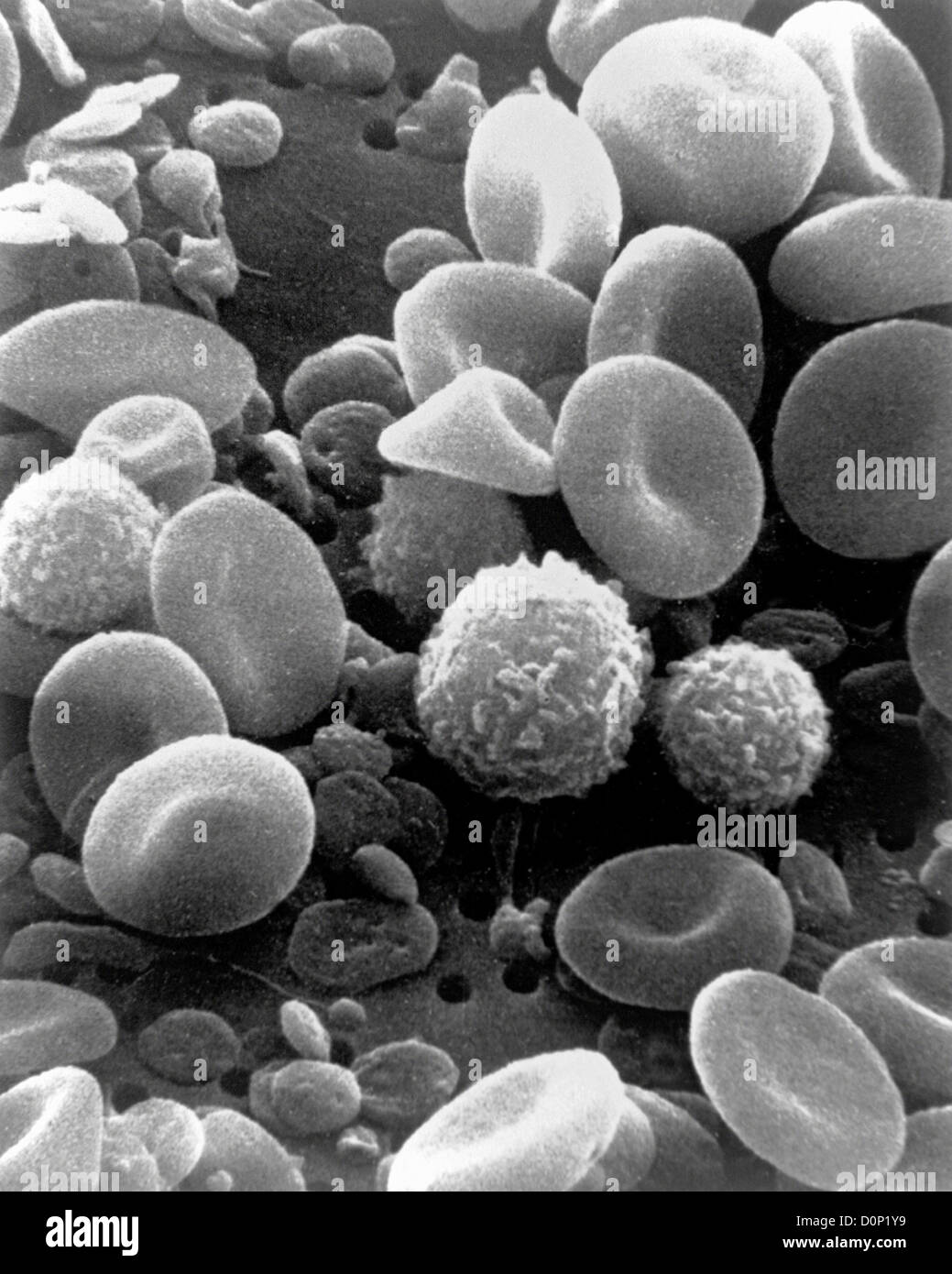 Un microsope électronique à vue de cellules du sang. non-ronde en forme de beigne nucléées cellules sont les globules rouges qui transportent Banque D'Images Un microsope électronique à vue de cellules du sang. non-ronde en forme de beigne nucléées cellules sont les globules rouges qui transportent Banque D'Images