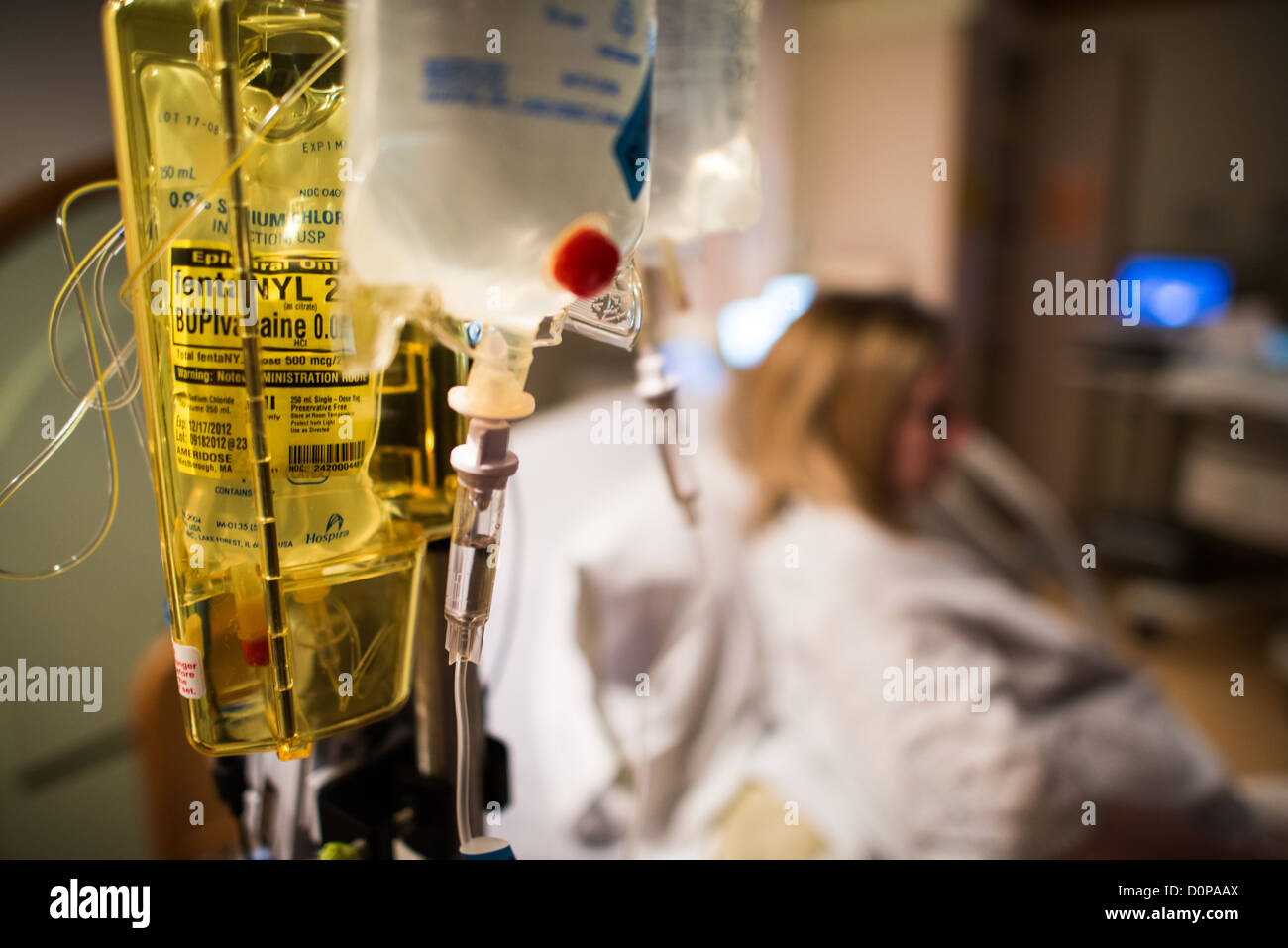 Sac de perfusion IV d'hôpital Fentanyl Épidural Fond de patient | ÉTATS-UNIS — Un sac de perfusion epidural portant l'étiquette fentanyl citrate et chlorhydrate de bupivacaïne est suspendu au premier plan tandis qu'un patient repose dans un lit d'hôpital en arrière-plan. L'analgésie épidurale délivre des opioïdes et un anesthésique local directement dans l'espace spinal, permettant un contrôle de la douleur lors de l'accouchement ou après une chirurgie à des doses bien inférieures à celles de l'administration intraveineuse systémique — réduisant la sédation tout en maintenant la sensation dans le bas du corps. Banque D'Images