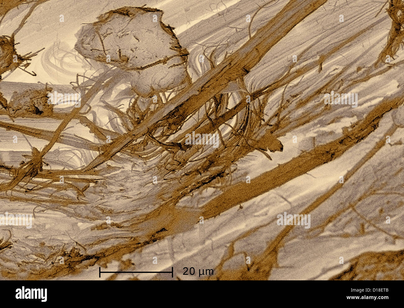Micrographie électronique à balayage de l'amiante, 1000x Banque D'Images