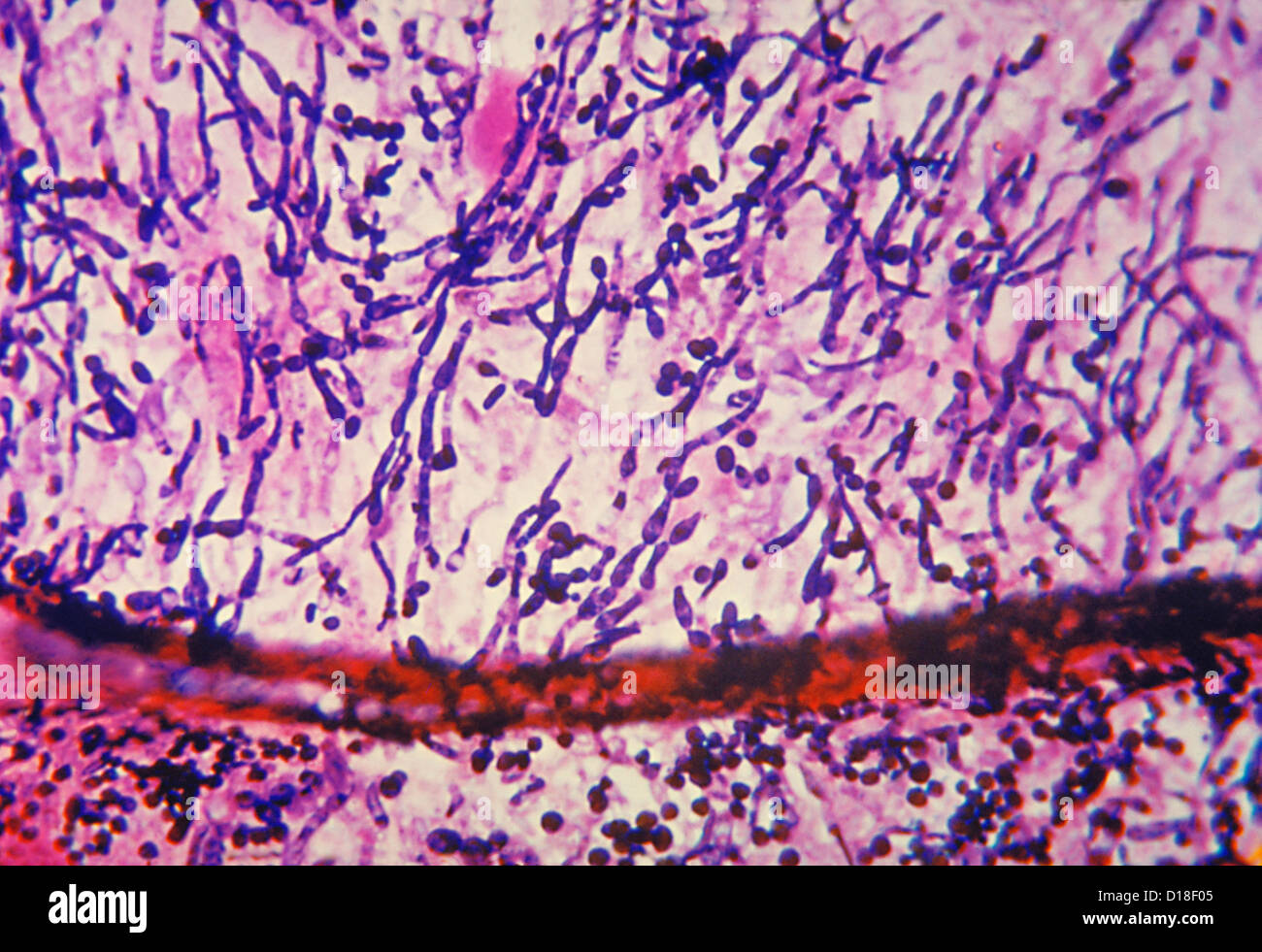 Micrograph Light de champignon Candida Banque D'Images