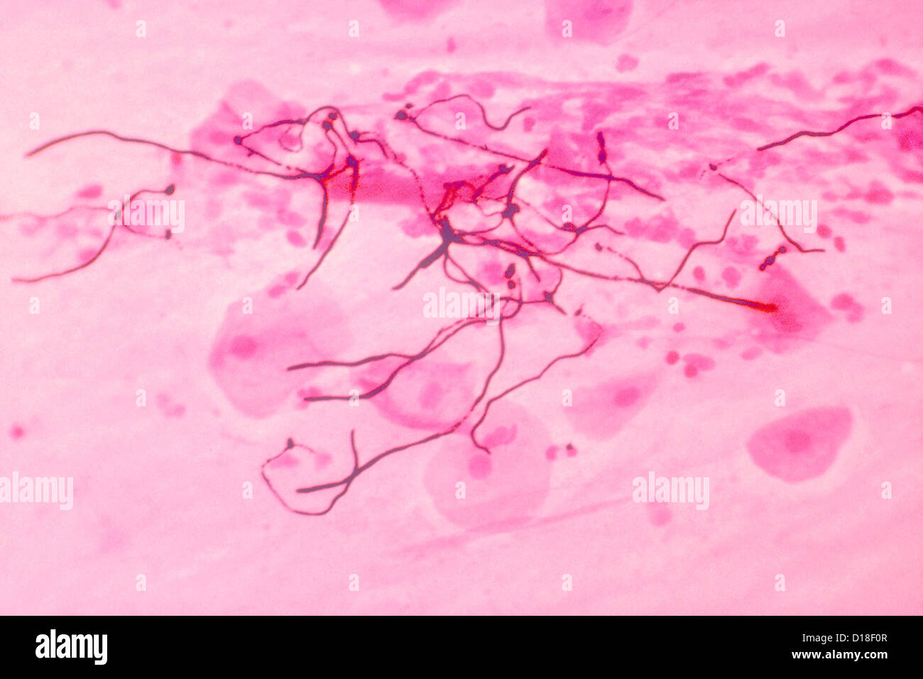 Light micrograph, Candida albicans dans les tissus pulmonaires Banque D'Images