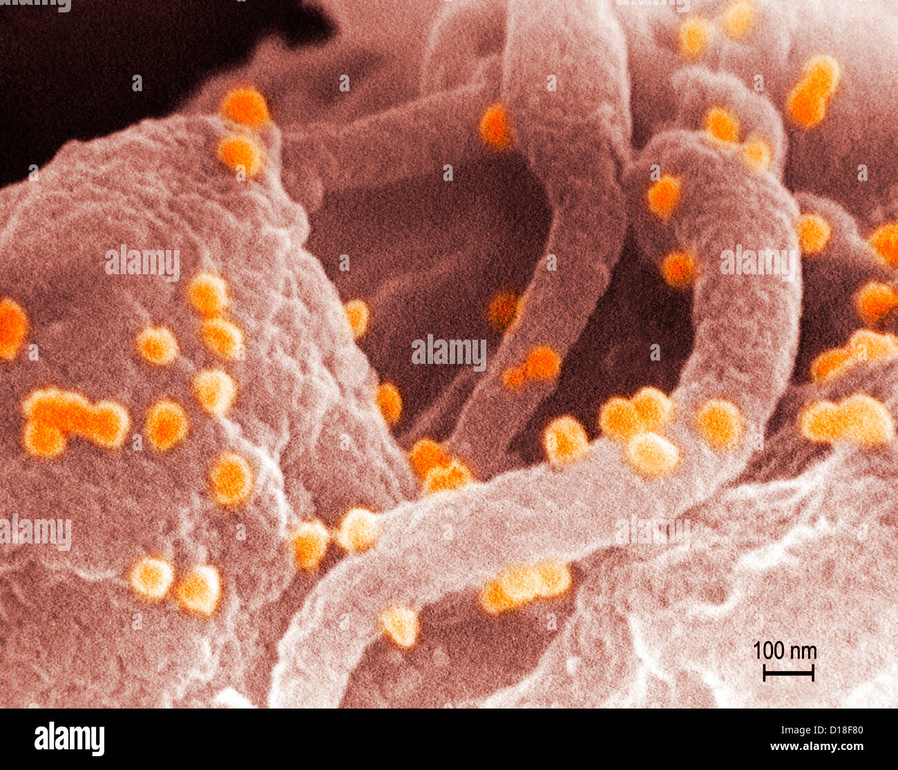 Le VIH-1 et lymphocytes humains Banque D'Images