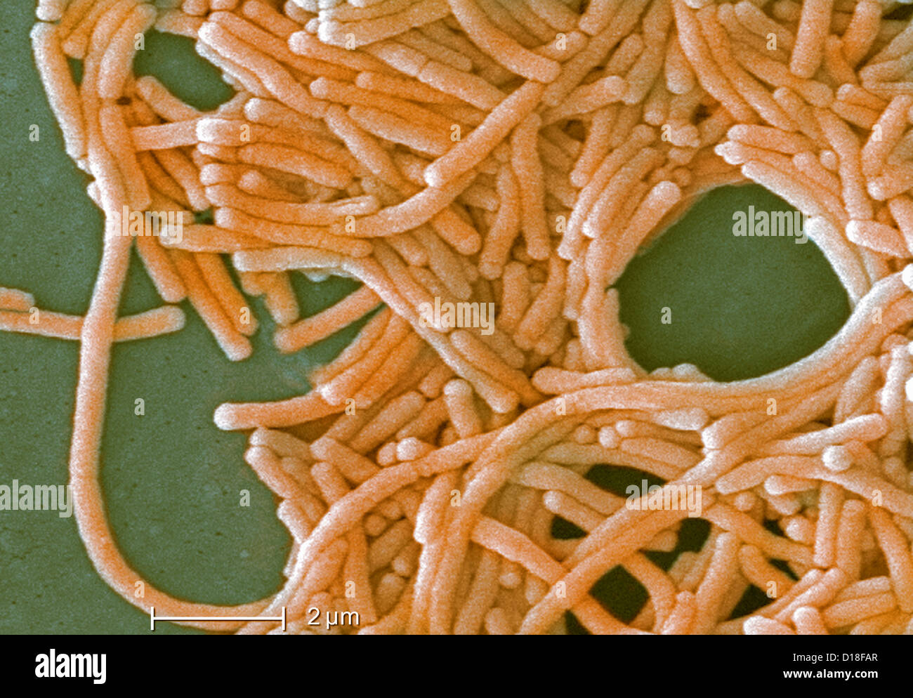 Micrographe de bactéries Legionella, 6500x Banque D'Images