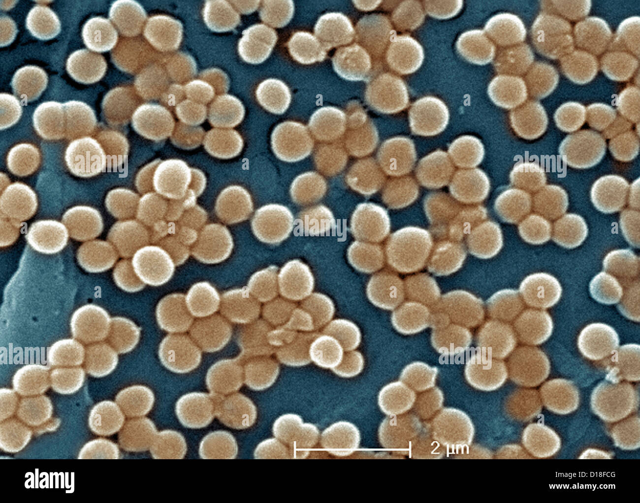 Micrographie électronique à balayage du SARM Banque D'Images